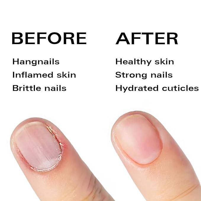 Nail Oil Cuticle Pen - Orange - Nail Strengthener & Growth Serum with Vitamin A, D, E, B5, Grapeseed & Natural Oils - Repair for Brittle, Peeling, Thin Nails - Twist Brush Pen