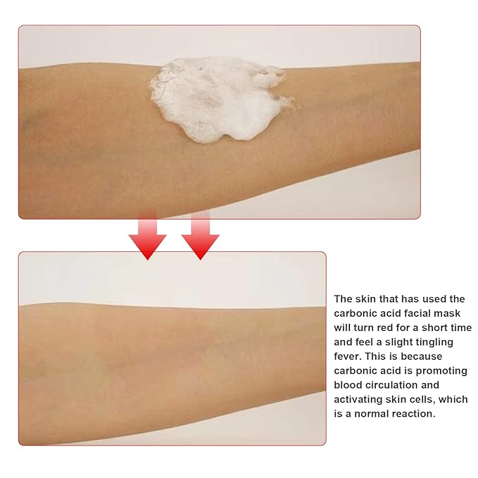 Elitzia CO2 Carboxy Gel Mask 1 box 20 bags Facial Care Skin Beauty ET1719 (Blue)