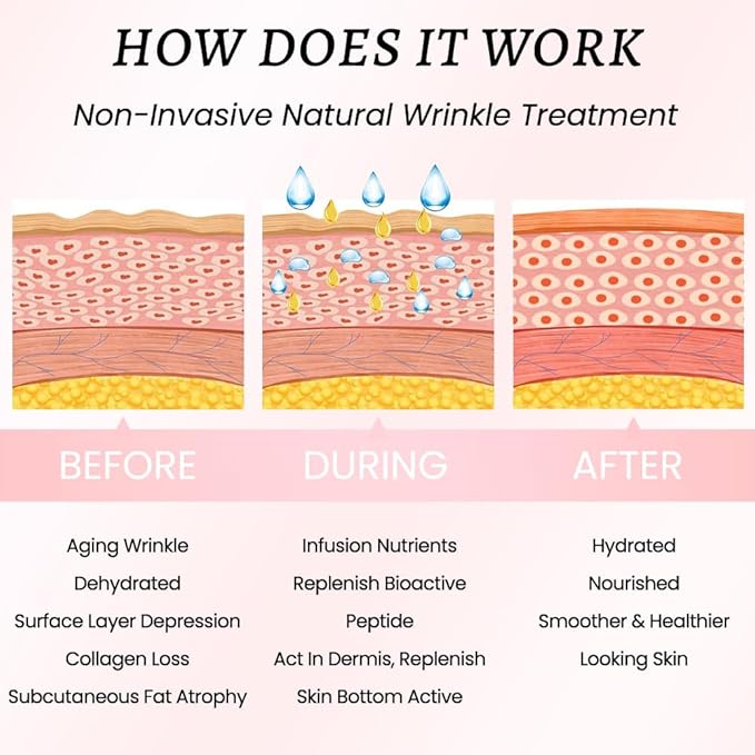 evpct 2Pcs Silicone Chest Smoothing Wrinkle Pads Reusable, Silicone Anti Chest Wrinkle Patches Reusable for Chest Wrinkles Overnight, Décolleté Chest Wrinkle Pillow Pads for Smoother, Size M-Peach