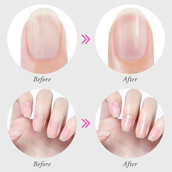 Cuticle Oils, Hydrating Oil for Repaired Cuticles, Nail Growth and Strengthener, Remedy for Thin Nails