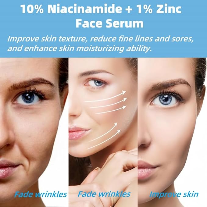 10% Niacinamide + 1% Zinc Face Serum, Nourishing & Refreshing Facial Serum ， Women Serum for Oil Control and Acne 30ML/1 Fl Oz
