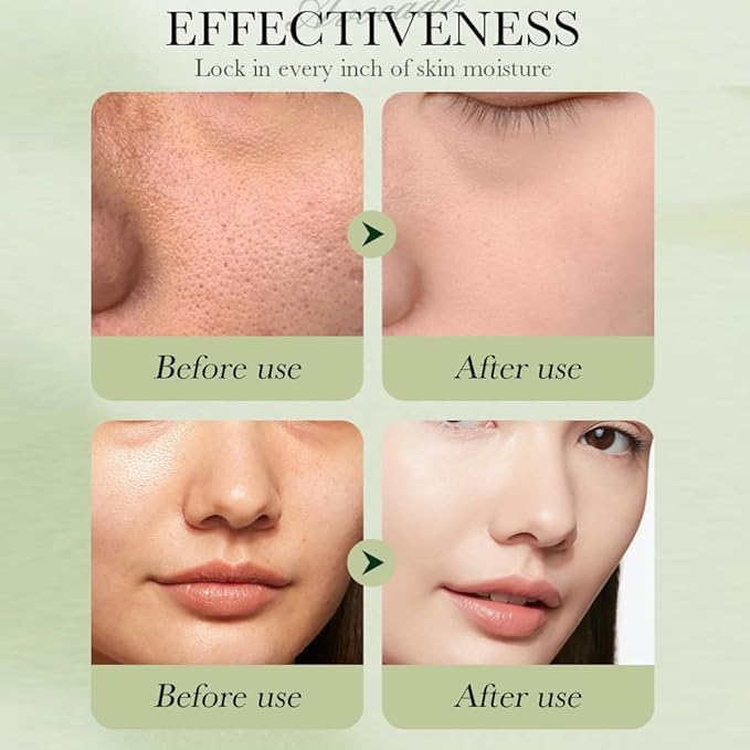 11pcs Avocado Skincare Kit, Skin Care Gift Set with Lip Balm, Toner, Lotion, Face Serum, Eye Cream For Hydrating Skin, Anti-Aging Skin For Women Teen Girls