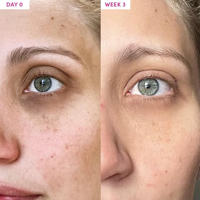 Sand & Sky Australian Essentials Anti-Aging Eye Cream with Peptides & Vitamin C - Under-Eye Brightening Formula, Reduces Dark Circles & Puffiness