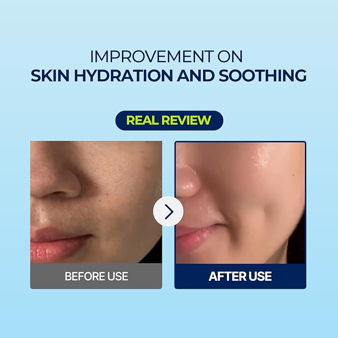 Torriden DIVE IN Hyaluronic Acid Facial Mask (10 sheets) | Extra Moisturizing Care | Hyaluronic Acid, Panthenol, Allantoin | Korean Face Mask