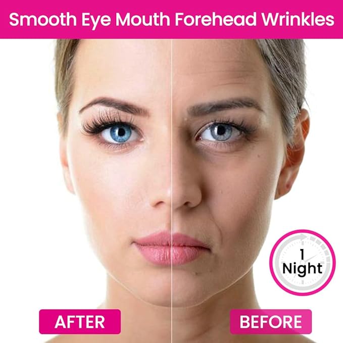 evpct 256Pcs Face Facial Medical Wrinkle Tapes Wrinkle Patches for Face Wrinkles Overnight, Smile Line Patches Face lifting tapes, Face oil Tape Smoothing Silicone face Forehead Wrinkle Patches