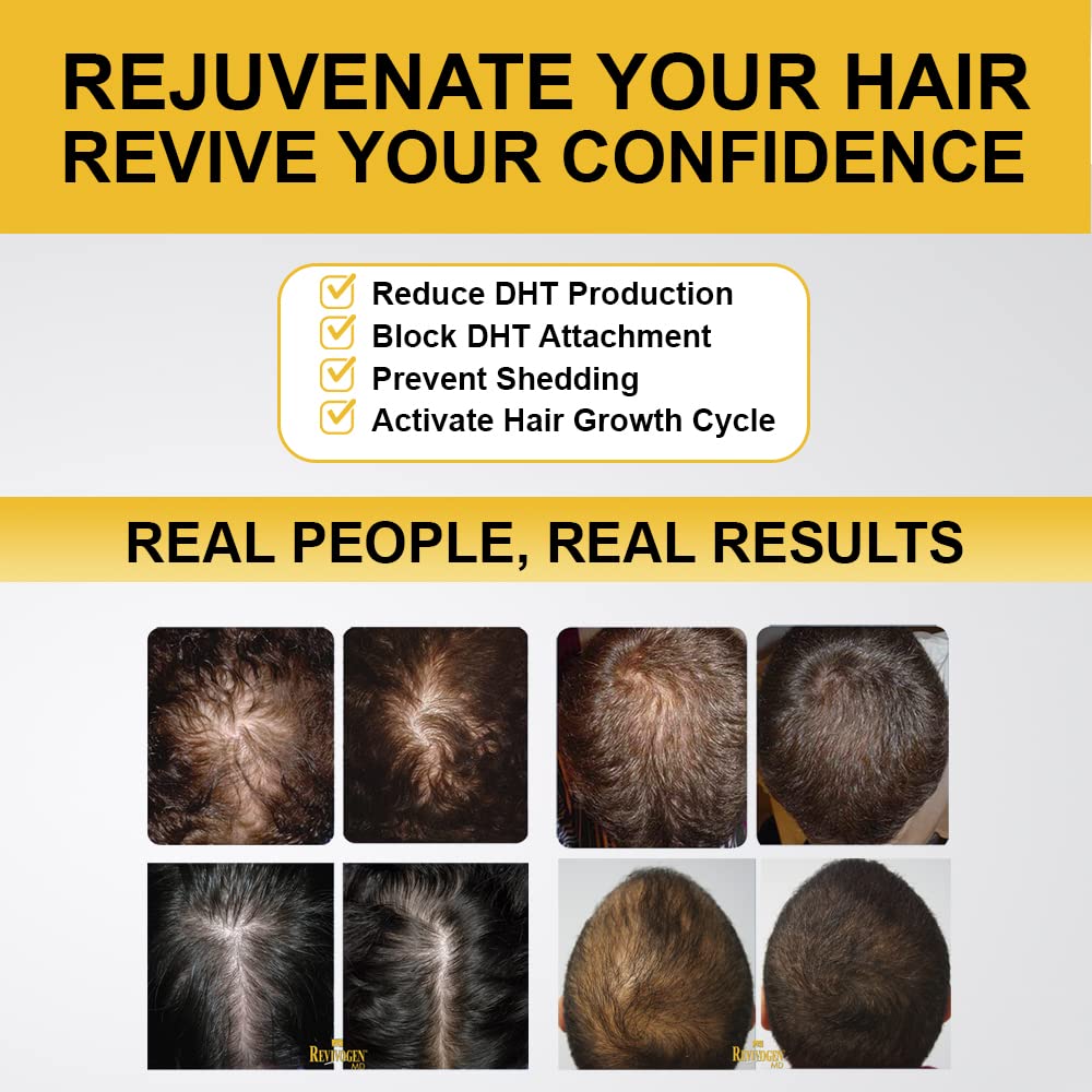 Revivogen MD Scalp Therapy Thinning Hair Solution, Shampoo & Conditioner Set