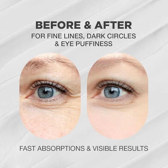 Hibiscus and Honey Eye Firming Cream and Multi Balm Bundle | Hibiscus and Honey Eye Firming Cream and Multi Stick Balm For Face, Neck and Body | Neck Firming Cream and Balm With Skin Bounce Complex