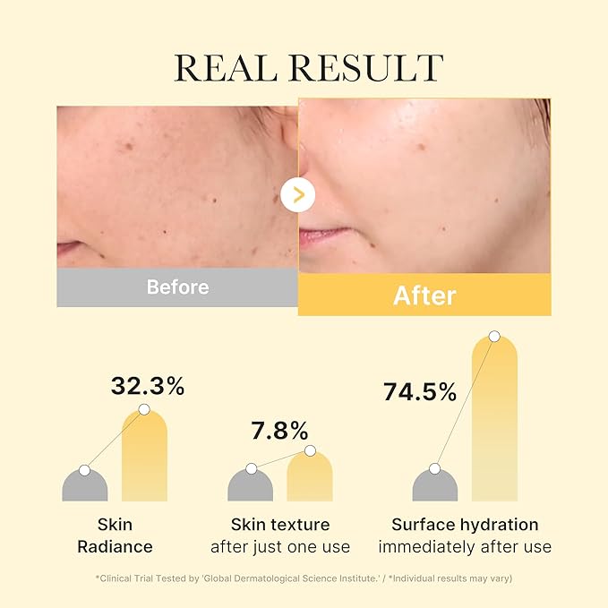 medicube Kojic Acid Turmeric Brightening Gold Jelly Gel Mask | Overnight Face Mask for Glass Glow Skin- Elasticity, Hydrating, Firming and Moisturizing | Korean Skincare, 28g x 4ea