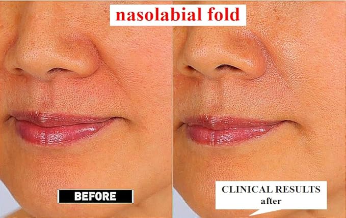 [K-Beauty Retinaldehyde 1000ppm & Liposome Anti-Wrinkle Night Repair Cream (1oz /30ml)