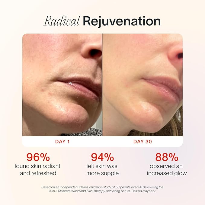 Solawave Red Light Therapy Starter Kit | 4-in-1 Radiant Renewal Wand, Serum and Refill Bundle | Anti-Aging Facial Device with Skin Therapy Activating Serum for Microcurrent and Galvanic Current