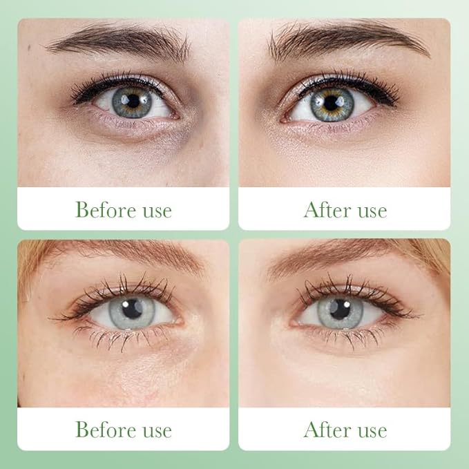 Aloe Vera Under Eye Mask, Avocado Under Eye Patches, 120 Pcs Moisturizing and Improving Eye Skin Dryness, Nourishing Eye Care Mask for Dark Circles and Puffiness (Avocado & Aloe)