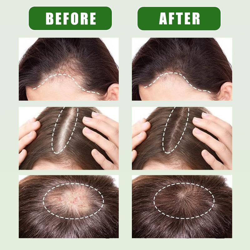 Unalakleet 100% Raw Batana Oil for Hair Growth – Botana Oil Hair Growth Treatment with Pumpkin Seed & Coffee | Vegan, Natural Hair Care for Thicker Hair | Pleasant Smell & Smooth Texture