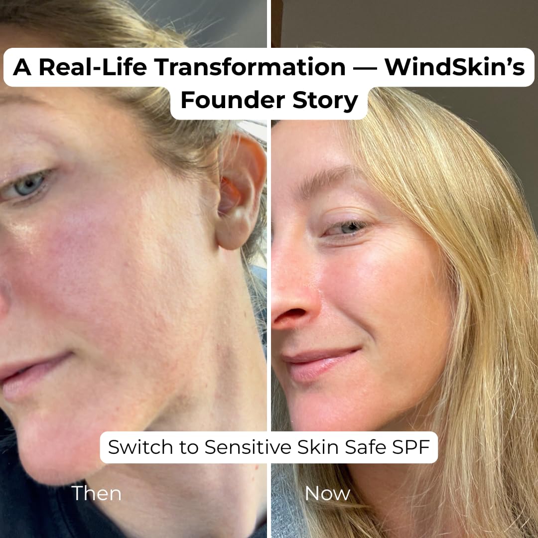 Sensitive Mineral Sunscreen Face SPF30 moisturizer, No white cast I Anti Aging I Non Toxic I Eco Friendly I made with zinc oxide for sensitive skin and acne prone skin, dermatologist recommended