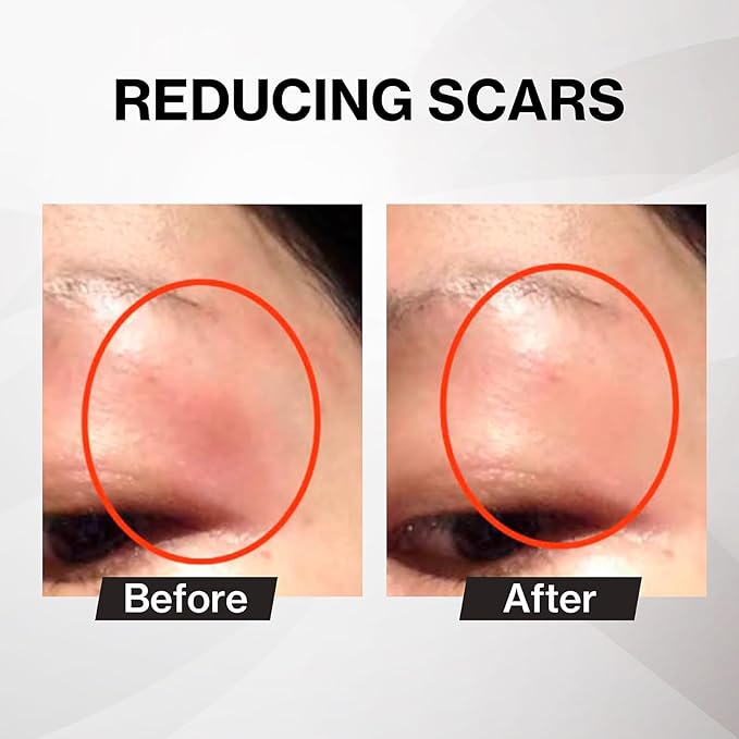 Japanese Placen Liposomal 200% Concentrated Serum, EGF, FGF, "HUMANANO", Paraben Free, Alcohol Free, Mineral Oil Free, Cruelty Free (3.38 fl oz)