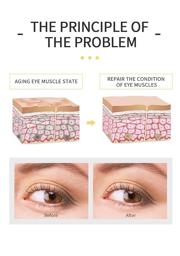 Banana Bright Eye Cream, Anti Aging Eye Cream with Squalane Dark Circle Under Eye Cream for Puffiness & Bags Moisturizing Firming & Wrinkle Repair Eye Treatment for Women & Men - 0.71 Fl Oz