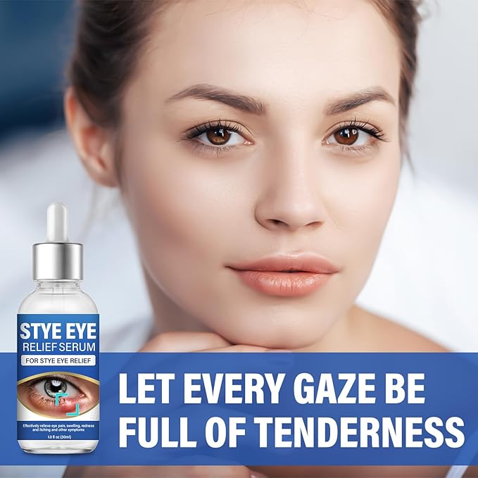 ITECFREELY Stye Eye Treatment, Natural Stye Eye Relief Drops Serum for Styes Chalazion and Blepharitis, Fast Chalazion Remover for Restore Healthier Skin(1 Fl.oz)