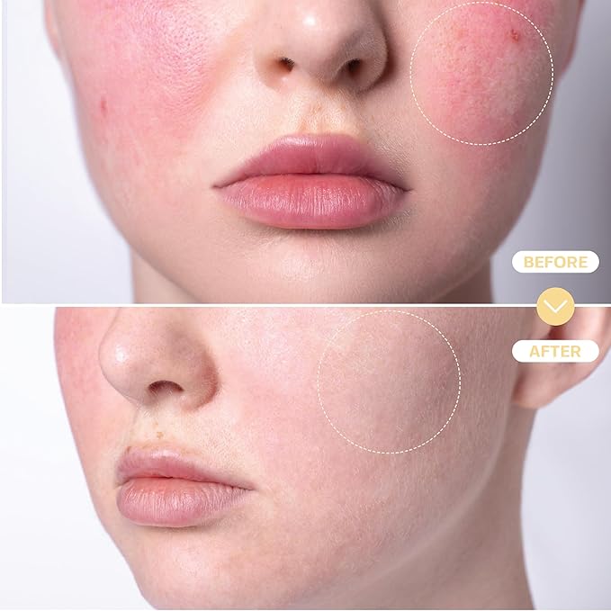 BASE LABORATORIES Hypochlorous Acid Spray for Face & Skin - Travel Size - Magic Facial Toner Spray & Cleaner - Skin Repair Solution helps reduce redness, acne - HOCL Molecule Spray 4oz (2 x 2oz) - 2PK