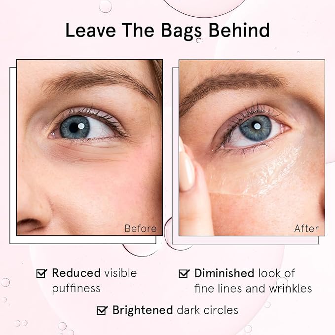 grace & stella Under Eye Brightener Roller - Travel Essentials - Retinol & Caffeine Eye Serum for Puffiness, Dark Circles, Wrinkles - Hydrating & Smoothing - Vegan Skincare (15ml / 0.51 fl oz)