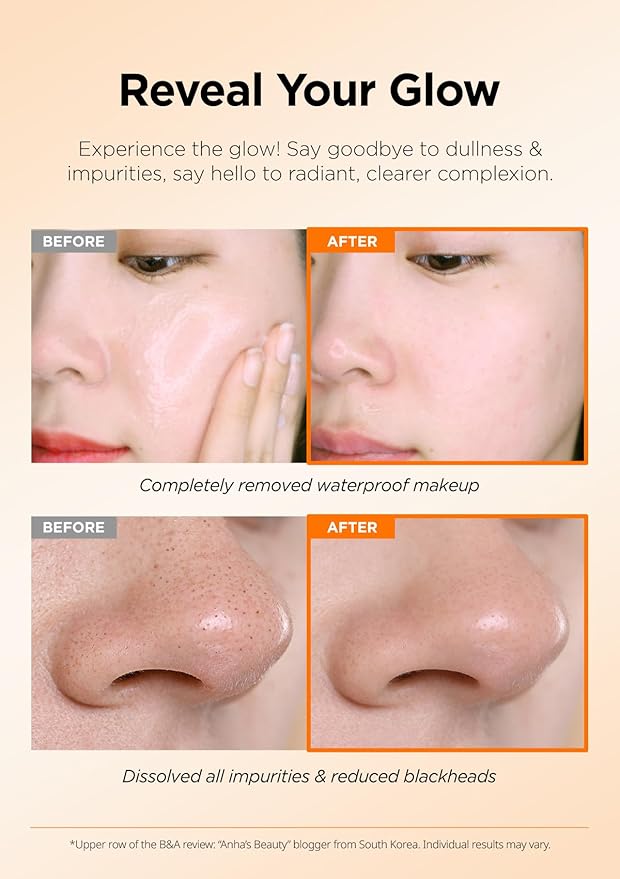 Hanskin AHA Pore Cleansing Balm, For Dry Skin, Exfoliating, Gentle Blackhead Cleanser and Makeup Remover Balm [AHA/2.82 oz]