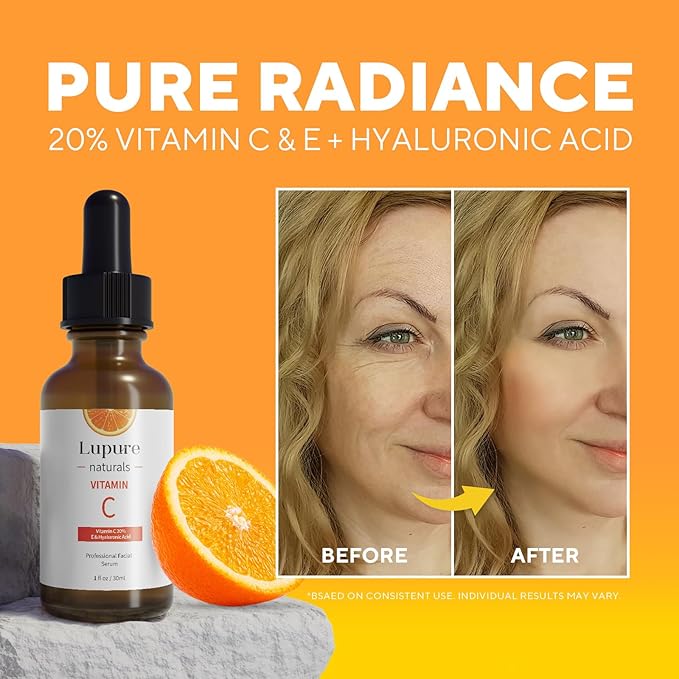 Professional Vitamin C Face Serum 20%, Anti Aging Facial Super Vit C Serum with Ascorbic Acid Hyaluronic Acid & Vitamin E for Dark Spots, Skin Care, Christmas Gift & Stocking | 1 Fl. Oz