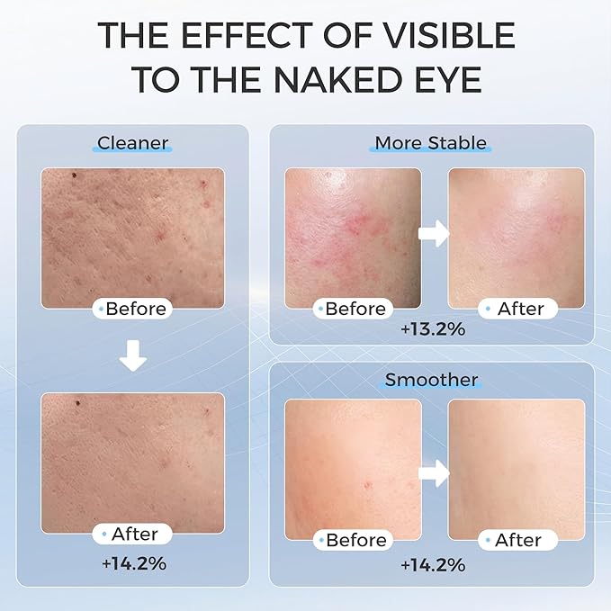 Led Face Mask Light Therapy, Red Light Therapy for Face, 7-1 Colors LED Facial Skin Care Mask, Black