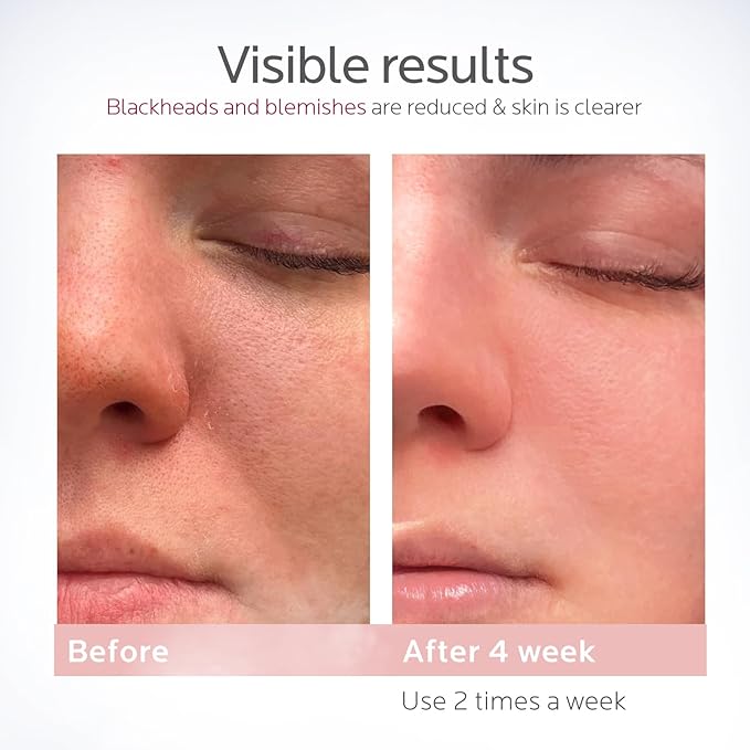 Colorfarm Facial Steamer Nano Ionic: Smart Face Steamer Deep Cleaning Unclogs Pores - Humidifier Hot Mist Home Sauna Spa for Women Men with LCD Display Steam Timer