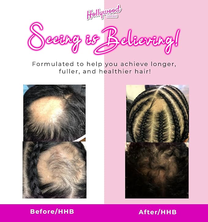 Hollywood Hair Bar | Hair Oil Regrowth Serum - Regular Strength, Made with All-Natural Essential Oils (Squeeze Bottle) 2 oz