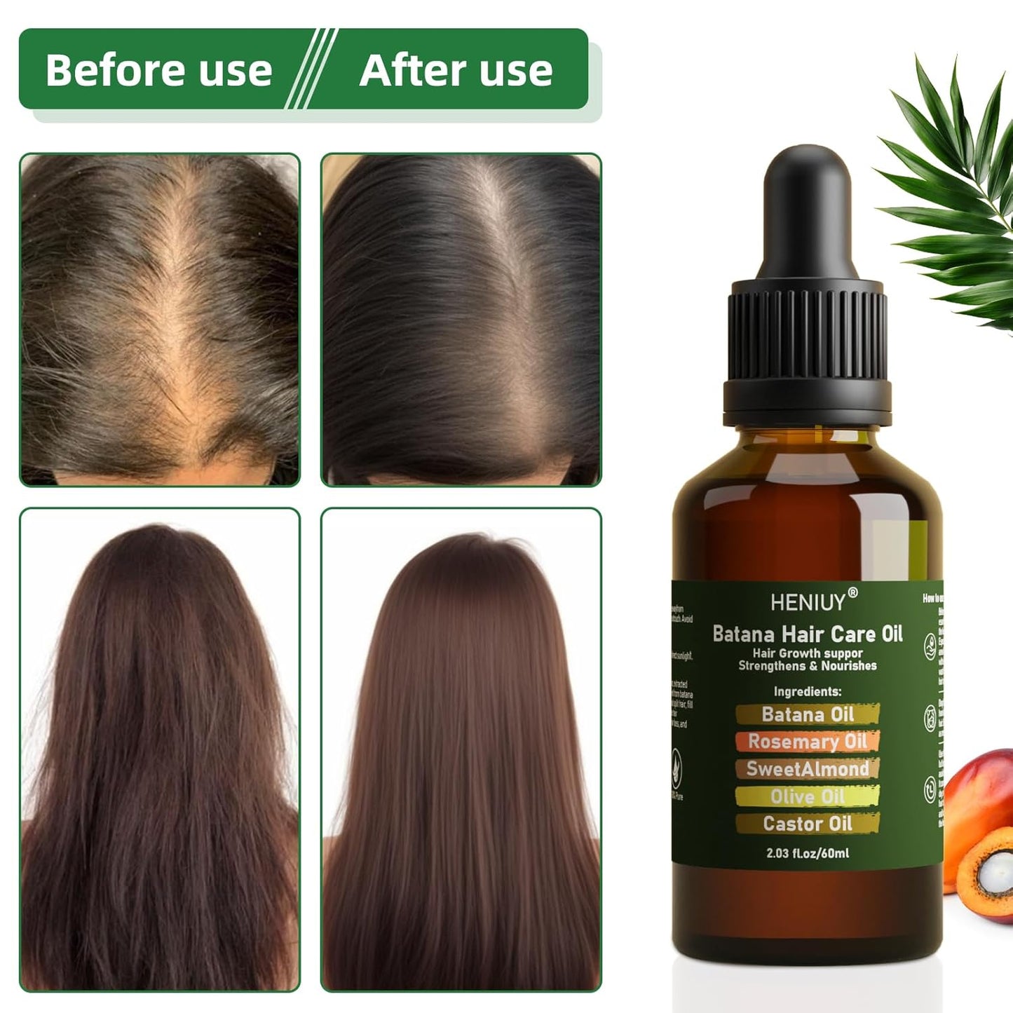 Battana Hair Care Oil – 2Fl Oz Natural Rosemary & Sweet Almond Oil Blend for Hair Growth & Repair – Organic, Vegan, Cruelty-Free – Lightweight, Non-Greasy Formula for Women & Men