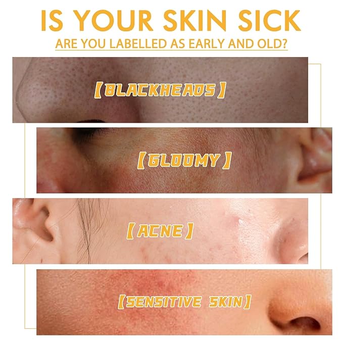 Glowtulip Honey Tearing Mask, Blackhead Control Honey Peel Mask for Face,Face Deep Cleasing & Moisturizing Mask,For All Skin (3PC)