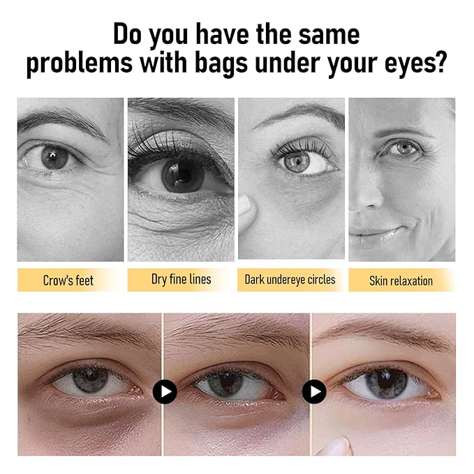 Elegacell Temporary Eye Tightener Cream Instant Firm Eye - Smooth the Look of Fine Lines, 1 Fl oz / 30ml