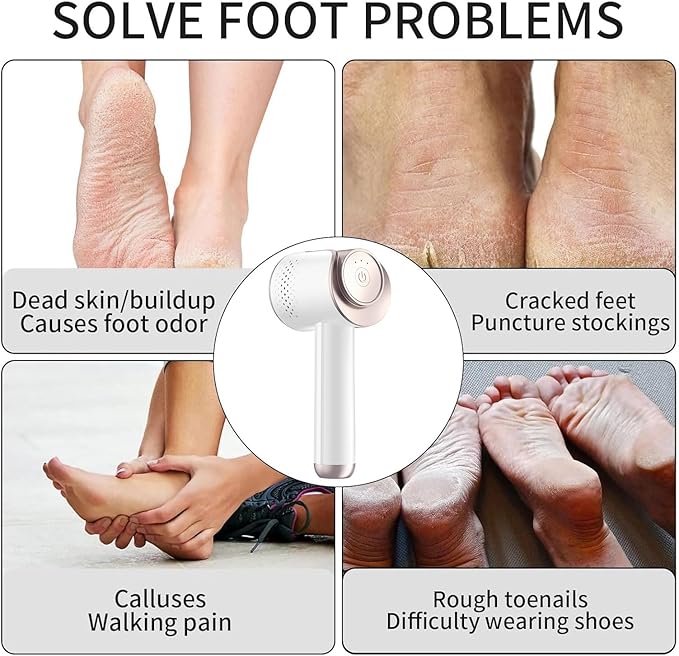 Electric Foot Callus Remover, Rechargeable Foot File Callus Remover for Feet, Portable Foot Scrubber with 10in1 Pedicure Tools for Feet Cracked Heel Dead Skin, 6 Rollers, 3 Speed