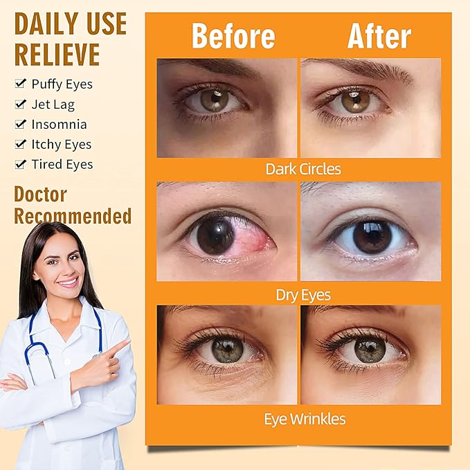 Serfeymi 10 Packs Steam Eye Masks,Disposable Self Heated Warm SPA Moist Eye Mask Compress Pad for Sleeping,Eye Fatigue Relief,Christmas Stocking Stuffers - Upgraded Scent-Chamomile