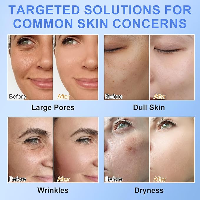 Collagen Face Mask, Deep Collagen Mask Overnight, Anti-Wrinkle Lifting Face Masks Skincare, Hydrating Face Masks Overnight Face Mask Collagen Face Mask for Women, Facial Masks for All Skin Types 6PCS