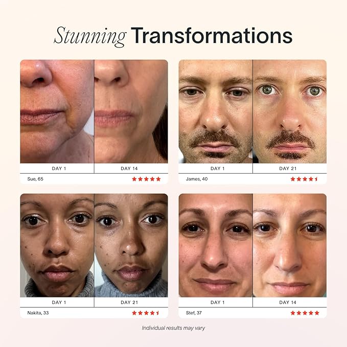 Solawave 4-in-1 Red Light Therapy Facial Wand | Anti-Aging Red Light Therapy | Galvanic Microcurrent Facial Massager | Wrinkle Reduction | Charcoal