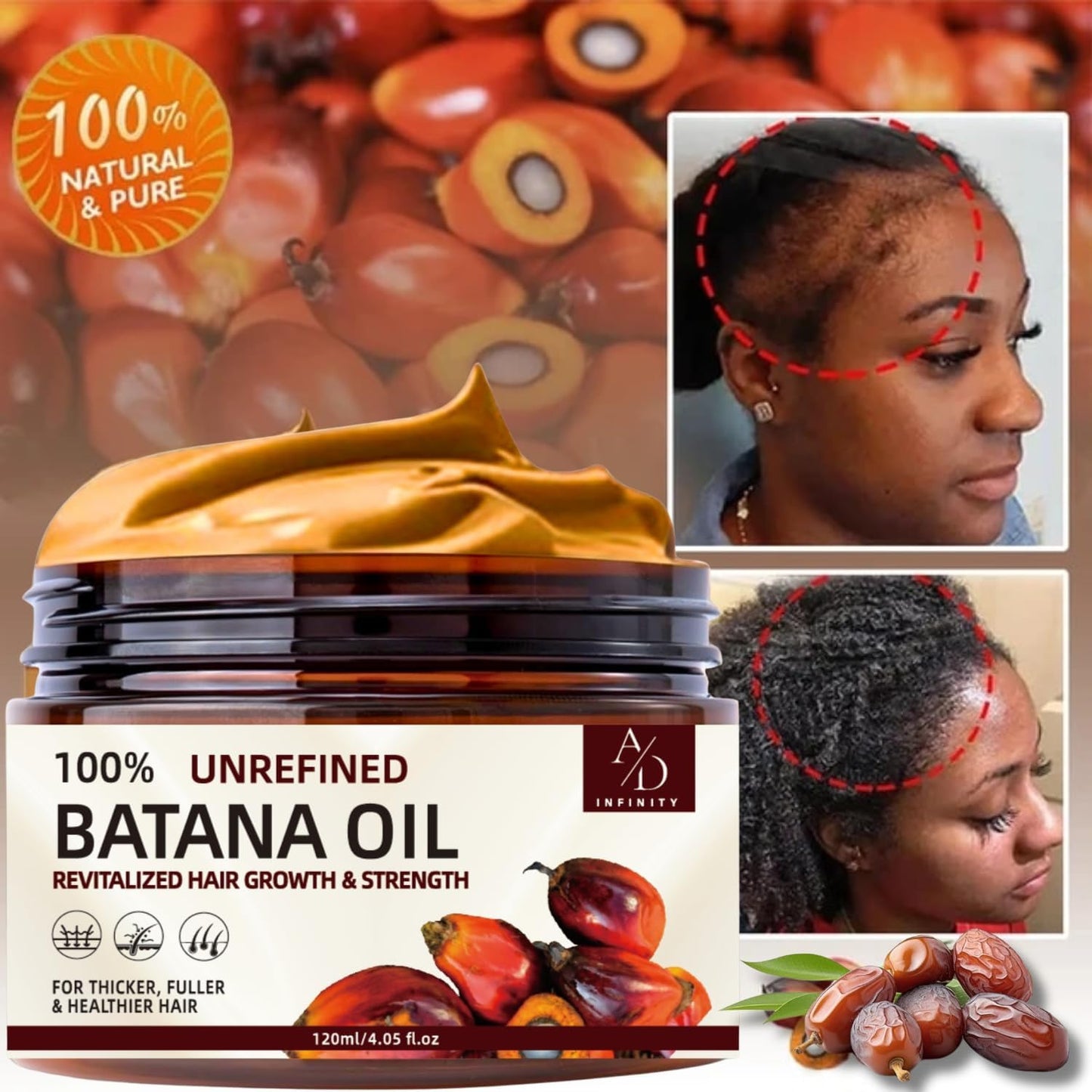 100% Unrefined Raw Batana Oil for Hair Growth Dr. Sebi Organic Pure from Honduras with Keratin, Coffee Extract & Other Ingredients to Enhance Efficacy for Thicker, Strength - Botana Oil 4oz