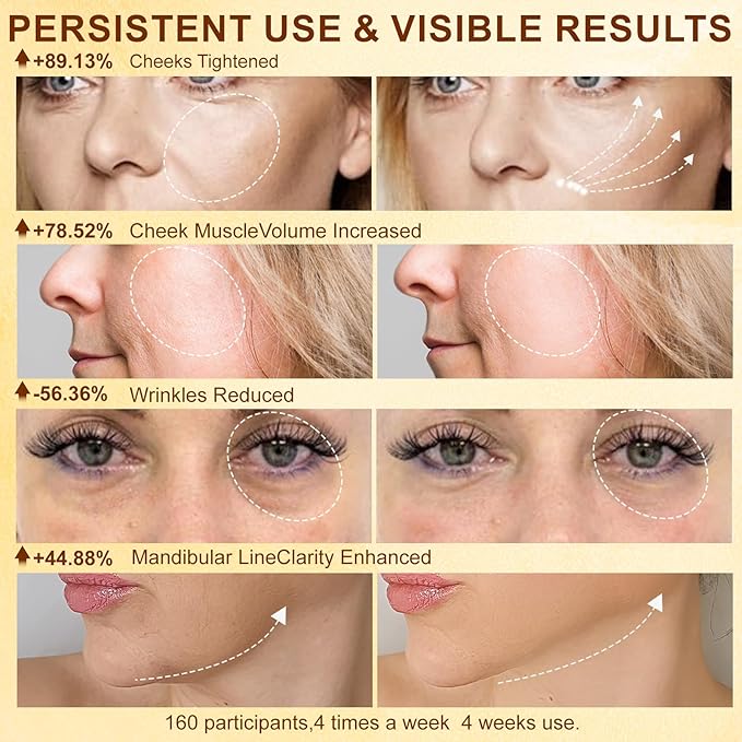 Microcurrent Facial Device,Radio Frequency Skin Tightening Face Machine Treatment of Facial Wrinkles and mild to Moderate inflammatory