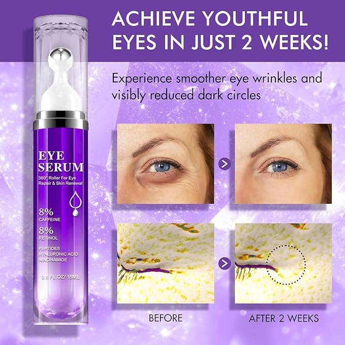 Eye Serum for Dark Circles and Puffiness, Under Eye Cream Anti Aging for Puffiness and Bags with 360° Eye Roller Massage Ball, Eye Serum with 8% Caffeine 8% Retinol for Women & Men