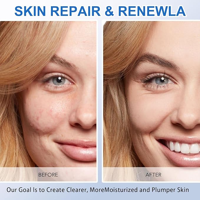 5% Hyaluronic Acid Serum,Acid Serum for Face,UltraHydrating Serum 5% Hyaluronic Acid Smoother Skin,Anti-Aging,Hyaluronic Acid Tubes Single-Use Vials Pre-makeup Skincare(1.5 ml*30)