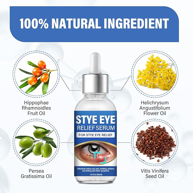 ITECFREELY Stye Eye Treatment, Natural Stye Eye Relief Drops Serum for Styes Chalazion and Blepharitis, Fast Chalazion Remover for Restore Healthier Skin(1 Fl.oz)