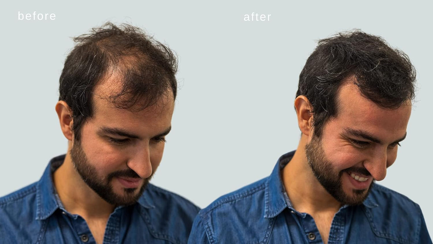 Hair Building Fibers - Volumizing Hair Fibers with real Keratin for Thinning Hair/Hair Loss Dermatologist Tested and Certified Hypoallergenic - 60 days + supply (Medium Brown)