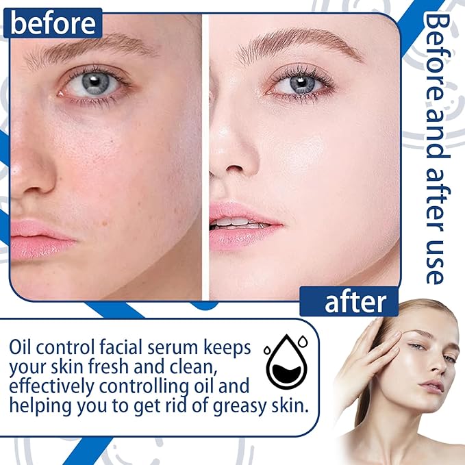 Moisturizing B5 Face Serum Mask,Lightweight & Oil Control Facial Serum,Hydrating Face Serum for Skin Care,B5 Facial Mask with Salicylic Acid