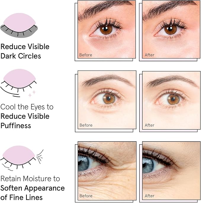 grace & stella Award Winning Under Eye Mask - Travel Essentials - Birthday Gifts for Women - Gel Eye Patches for Dark Circles, Puffy Eyes, Wrinkles, Undereye Bags - Vegan - Self Care (24 Pairs, Gold)