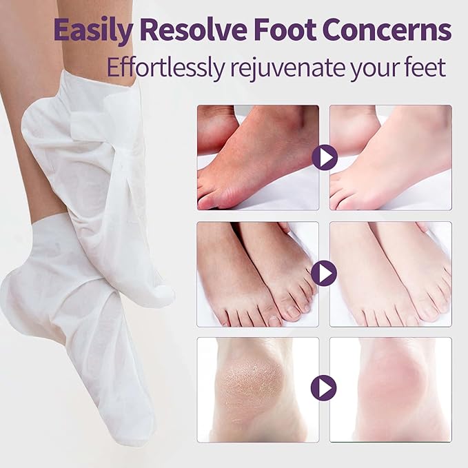 Moisturizing Foot Mask 5 Pack,Hydrating Foot Masks for Dry Cracked Feet,Moisturizing Socks Dry Skin Moisturizer for Soft and Smooth Touch Feet,Foot Care Spa Gifts for Women Men Mother's Day Gifts
