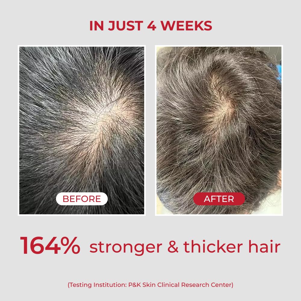 MOEV ANNURCATIN Shampoo | Korean Apple Hair Care for Strength and Volume in Thinning Hair | Adds Lift | Paraben-Free | Suitable for All Hair Types (10.14 fl.oz, apple & vanilla)