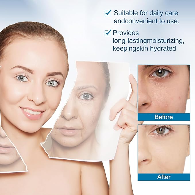 Micro Infusion System for Lips, Micro System for Face, SerumSmooth Skin Facial Serum for All Skin Types (1*Micro System Tool+4* Face Serum)