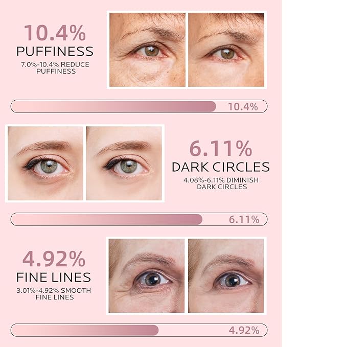 Dr. Pure Under Eye Patches for Puffiness: Caffeine Eye Mask for Dark Circles and Puffy Eyes with Niacinamide Hyaluronic Acid - Smooth Wrinkles Reduce Eye Bags Undereye Gel Pad (50 Pairs)