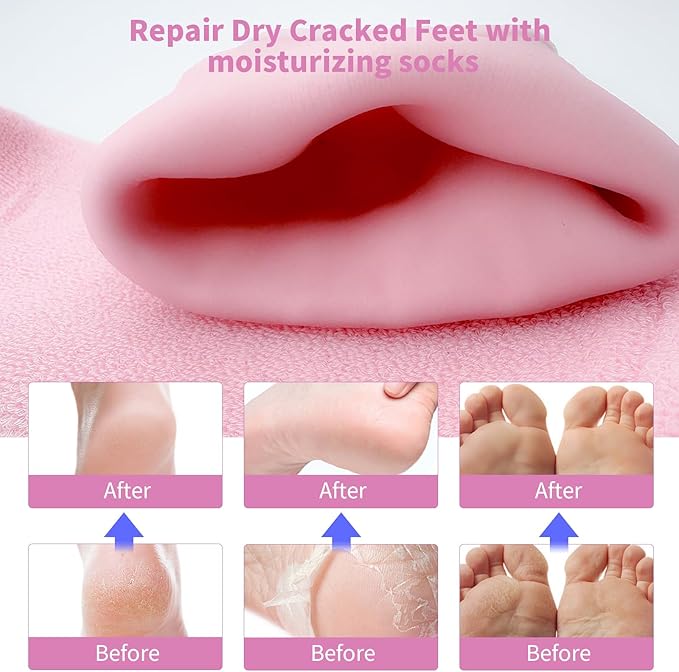 10" Large Silicone Moisturizing Socks for Women - 2Pairs Soft Gel Foot Moisturizing Socks for Dry Cracked Feet