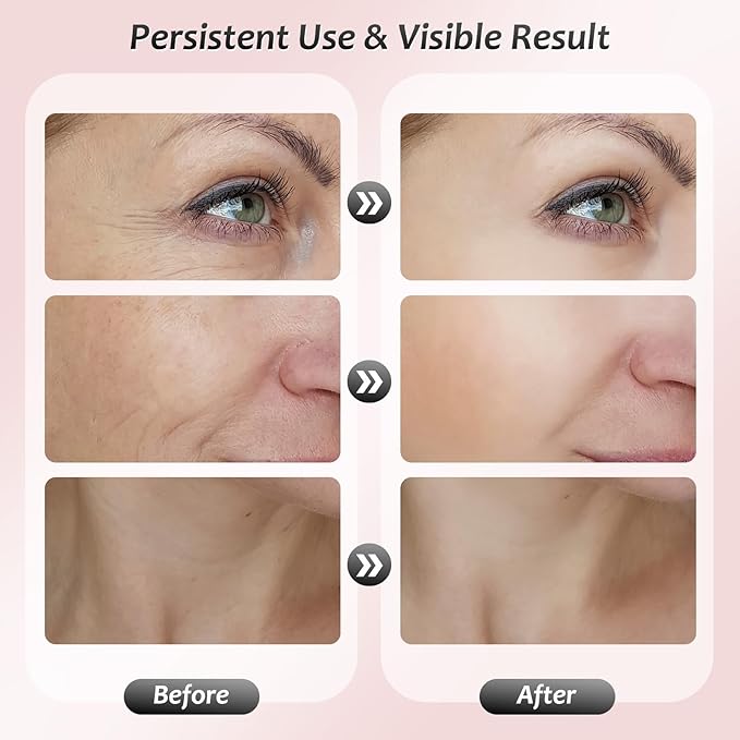 Face Massager Tool, Facial Massager 7 Color, Facial and Neck Massager, Multifunctional Facial Skin Care Tool, Face Neck Massager for Daily Skin Care Routine, White