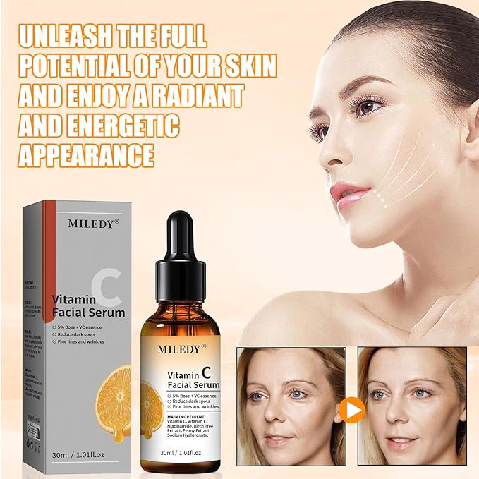 3PCS Vitamin C Facial Serum Essence,Vitamin C Vitamin E Facial Serum,Skin Moisturized,30ml / 1.01oz