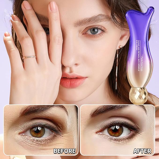 Caviar+Retinol Eye Cream for Wrinkles, 360° Massage Under Eye Cream Face and Eye Serum Firming and Lifting, Instant Hydrating, Deep Moisturizing for Dark Circles Puffiness Fine Lines, Bags